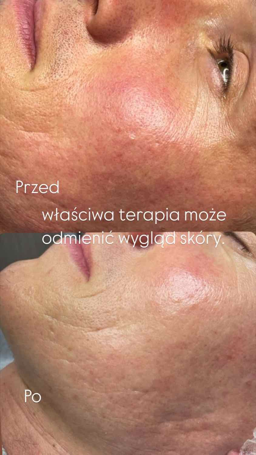 Efekt zabiegu — Maestria Beauty
