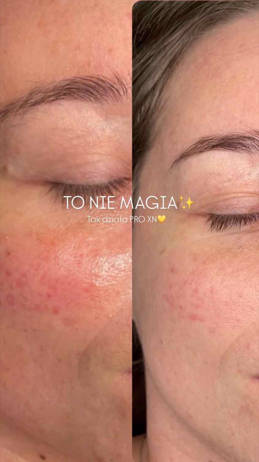 Efekt zabiegu — Maestria Beauty