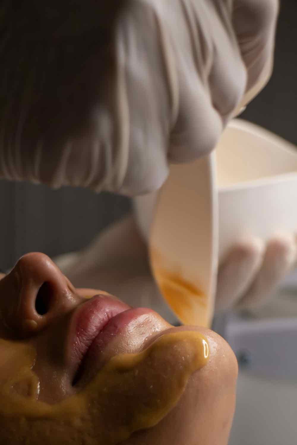 Aplikacja peelingu chemicznego